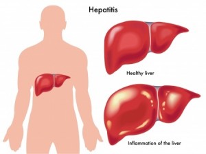 Hepatitis-C Health